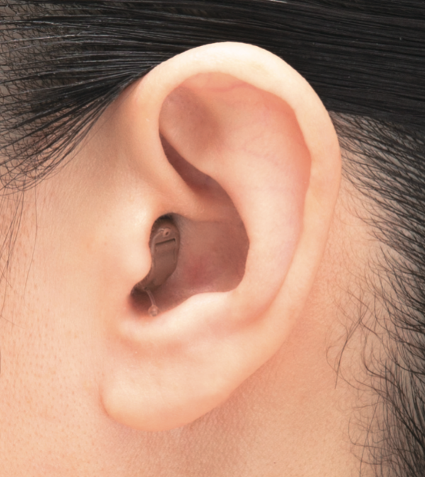 スターキーの既成耳あな型補聴器『イージーフィット３０』サムネイル